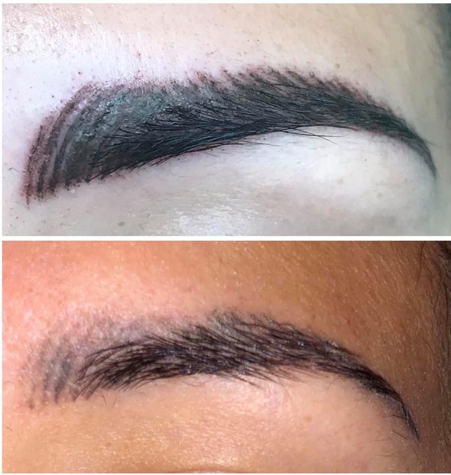 What Are The Alternatives To Eyebrow Tattooing?